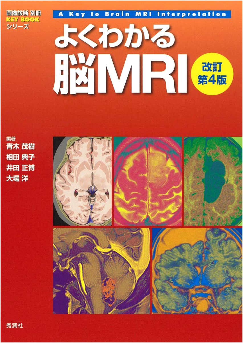 Comprehensive Guide to Brain MRI: Revised 4th Edition (Imaging Diagnosis KEY BOOK Series)