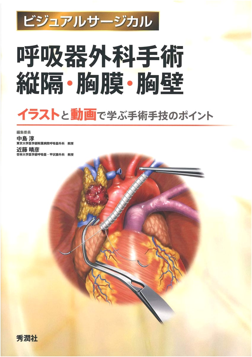 Respiratory Surgical Procedures: Mediastinum, Pleura, Chest Wall (Visual Surgical)