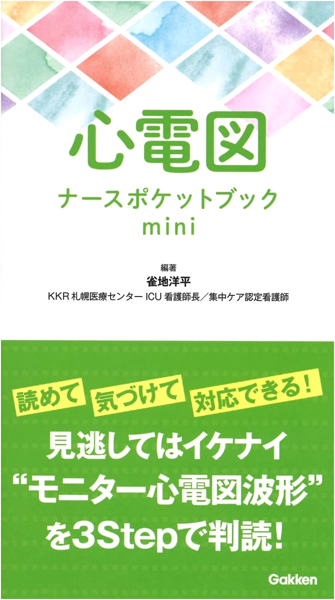 Mini ECG Pocket Guide for Nurses: Essential Electrocardiogram Handbook