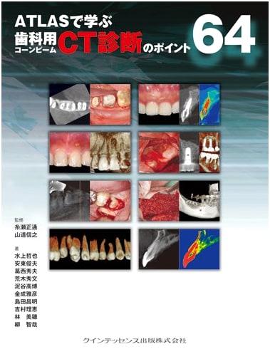 ATLAS Guide to Dental Cone Beam CT Diagnosis: 64 Key Points