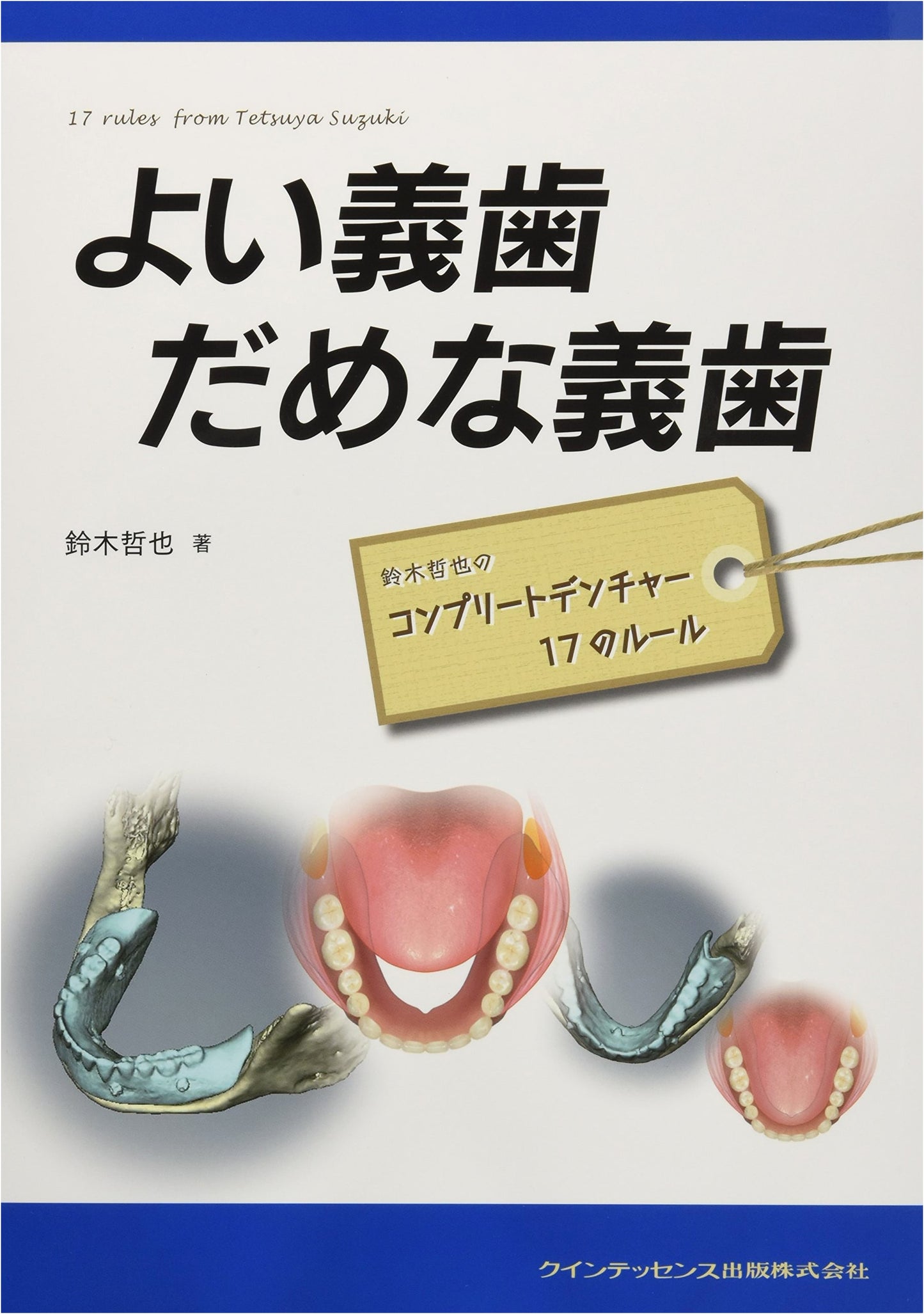 Good Dentures, Bad Dentures