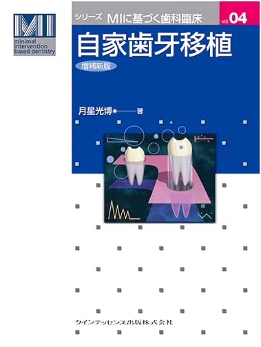 Autogenous Tooth Transplantation: Revised New Edition (Series: MI-Based Dental Clinical Practice)