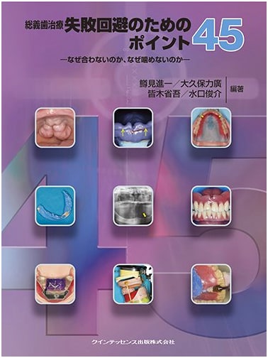 Complete Denture Treatment: 45 Key Points to Avoid Failure