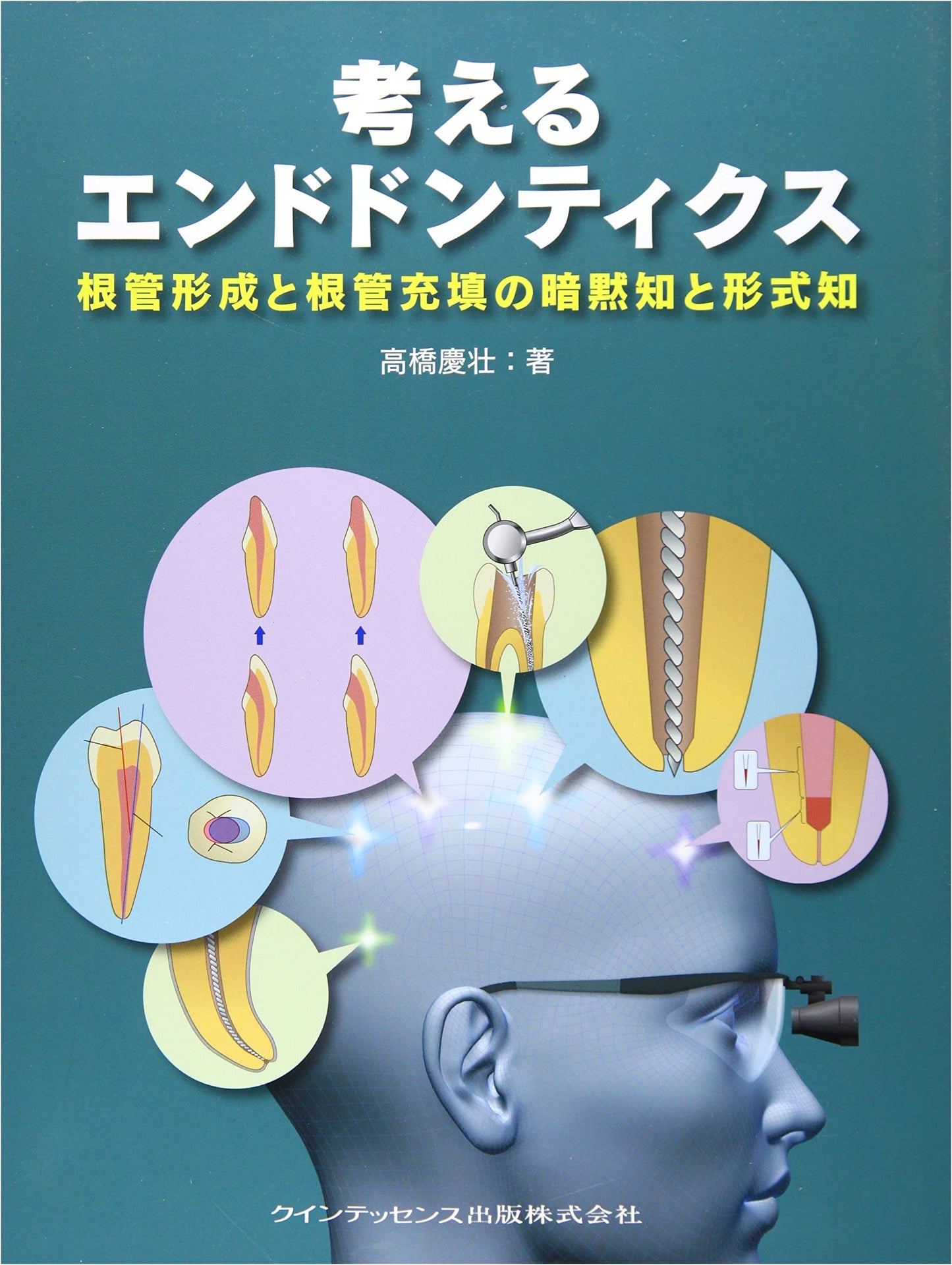 Thinking Endodontics