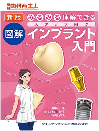 New Edition: Easily Comprehensible Illustrated Introduction to Implants for Dental Staff