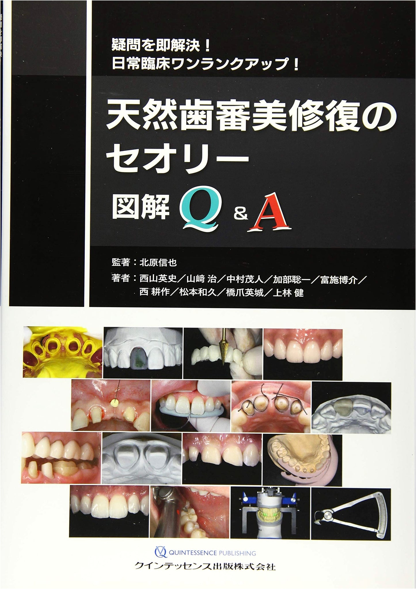 The Theory of Aesthetic Restoration for Natural Teeth: Illustrated Q&A