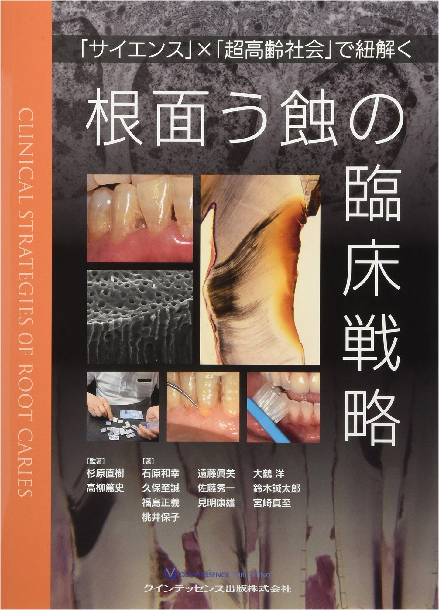 Clinical Strategies for Root Surface Caries