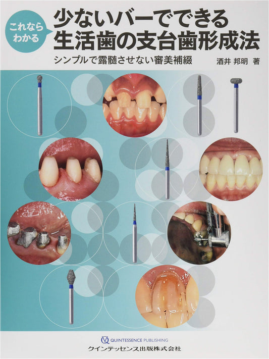 Easy Abutment Tooth Preparation for Vital Teeth Using Few Burs