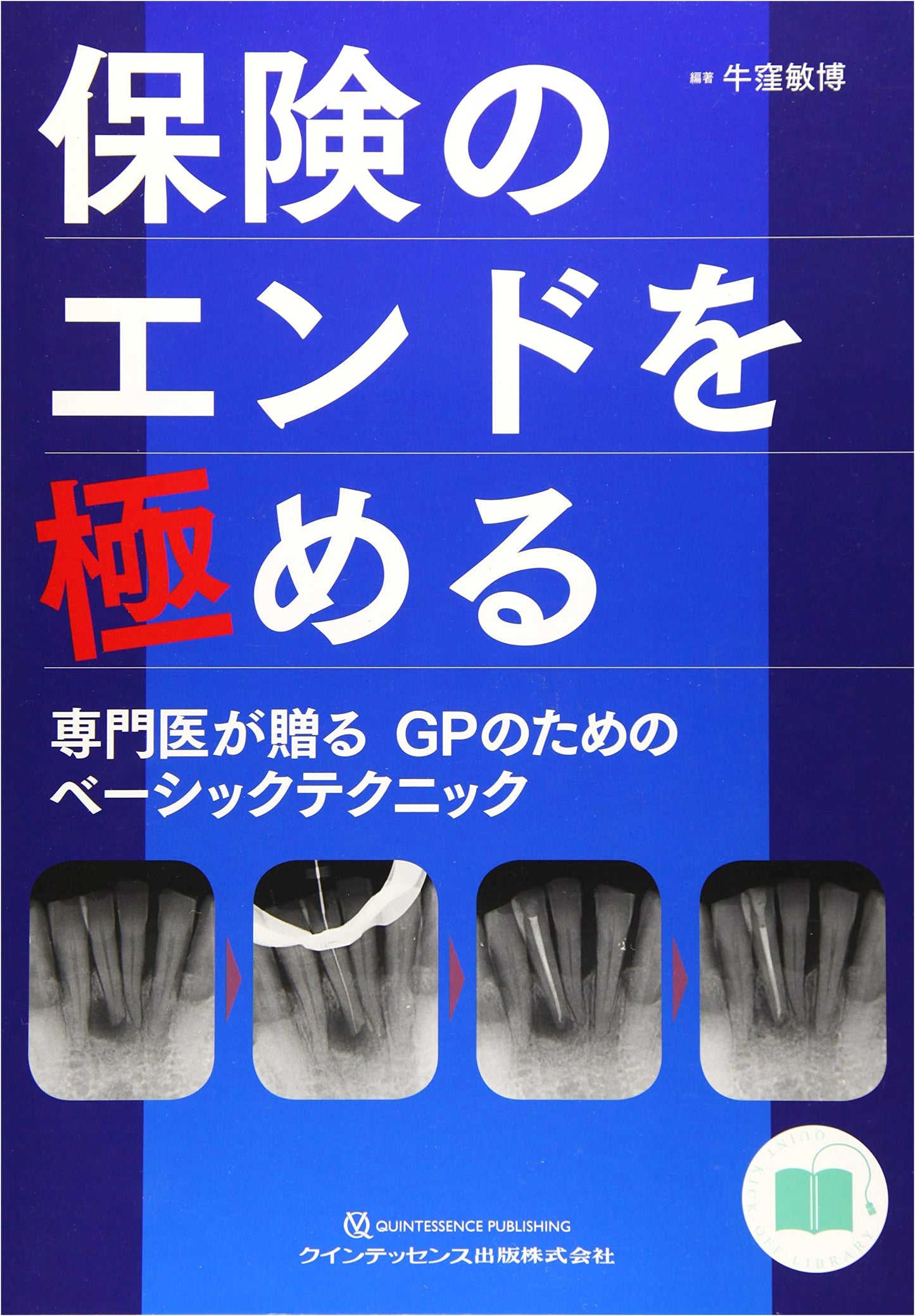 Mastering Endodontic Treatment Under Insurance (QUINT KICK-OFF LIBRARY)
