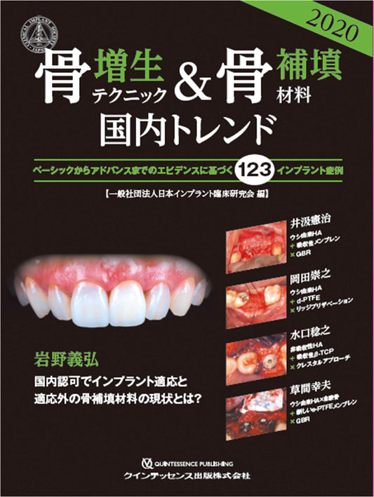 Bone Augmentation Techniques & Graft Materials: 2020 Japan Trends