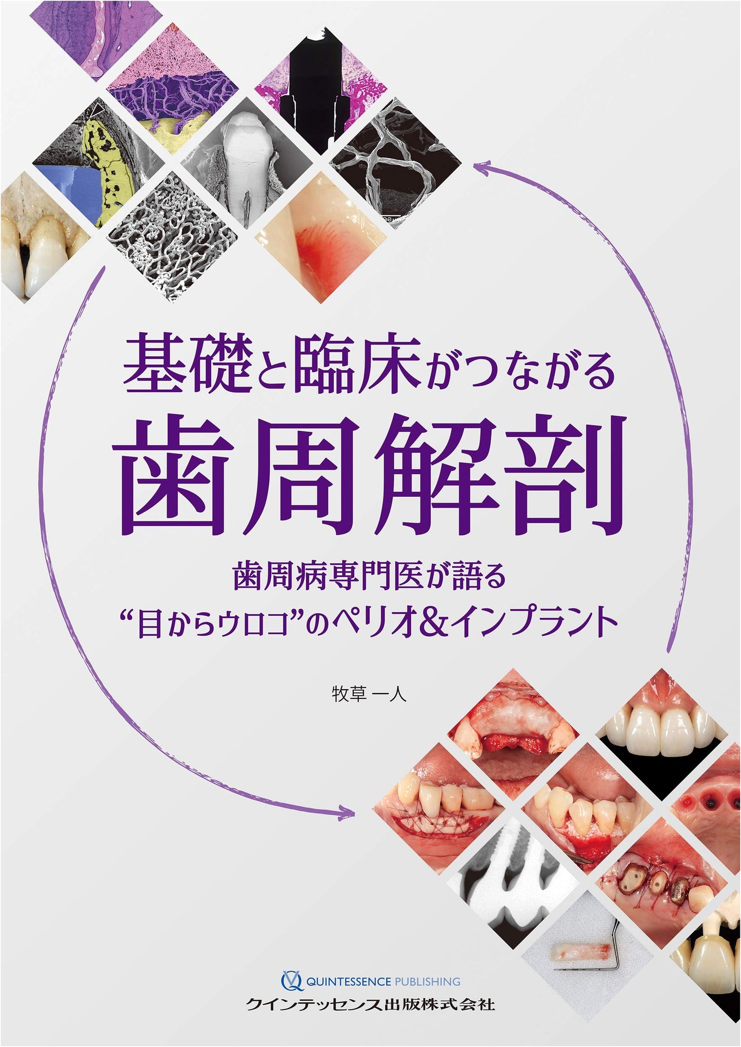 Periodontal Anatomy: Connecting Basic Science and Clinical Practice