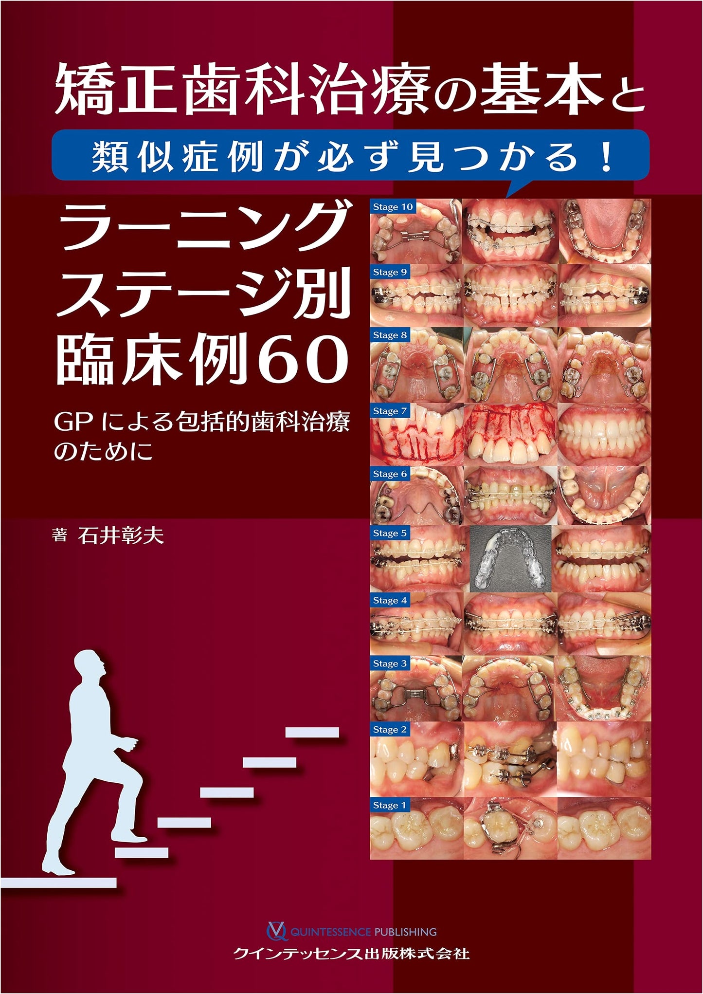 Orthodontic Treatment: Basics & Similar Cases - 60 Clinical Examples by Learning Stage