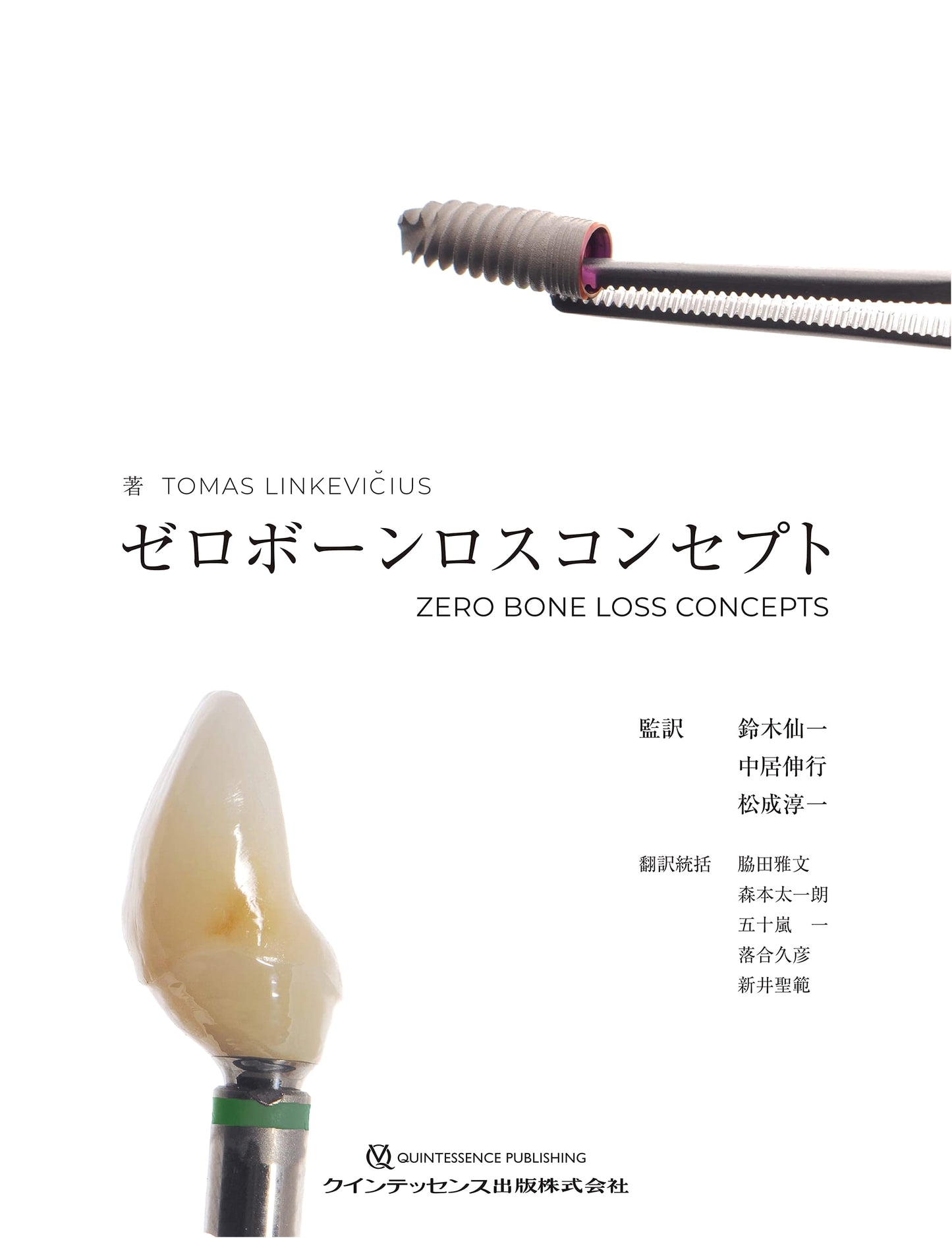 Zero Bone Loss Concept