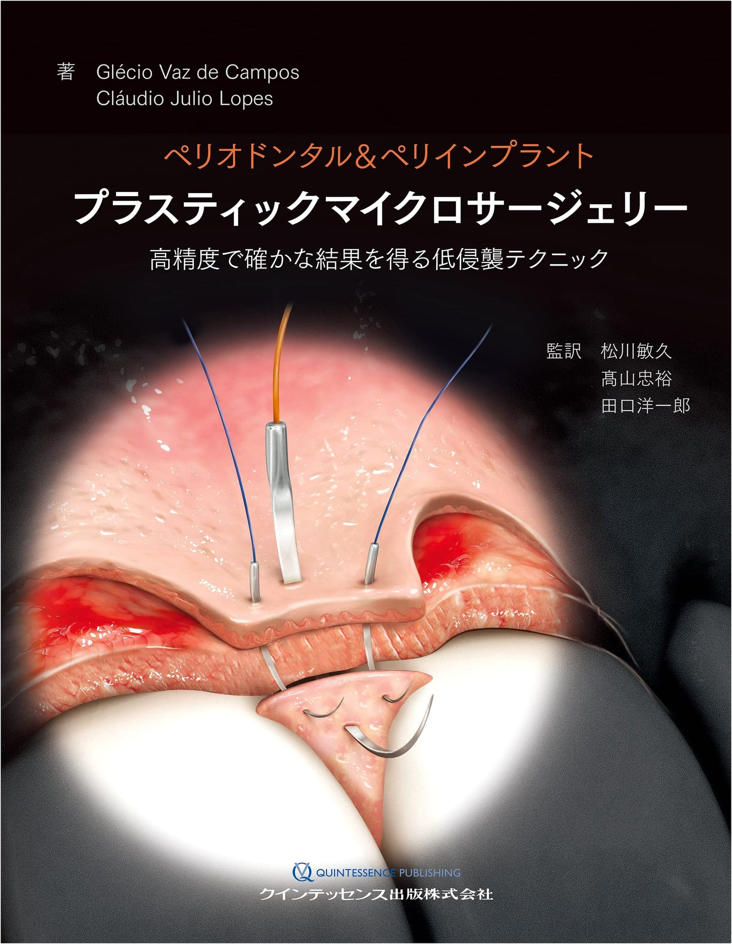 Periodontal & Peri-implant Plastic Microsurgery