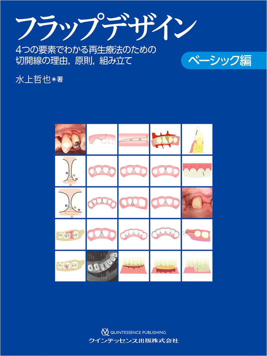 Basic Flap Design for Regenerative Therapy: Incision Lines, Principles & Construction via 4 Elements