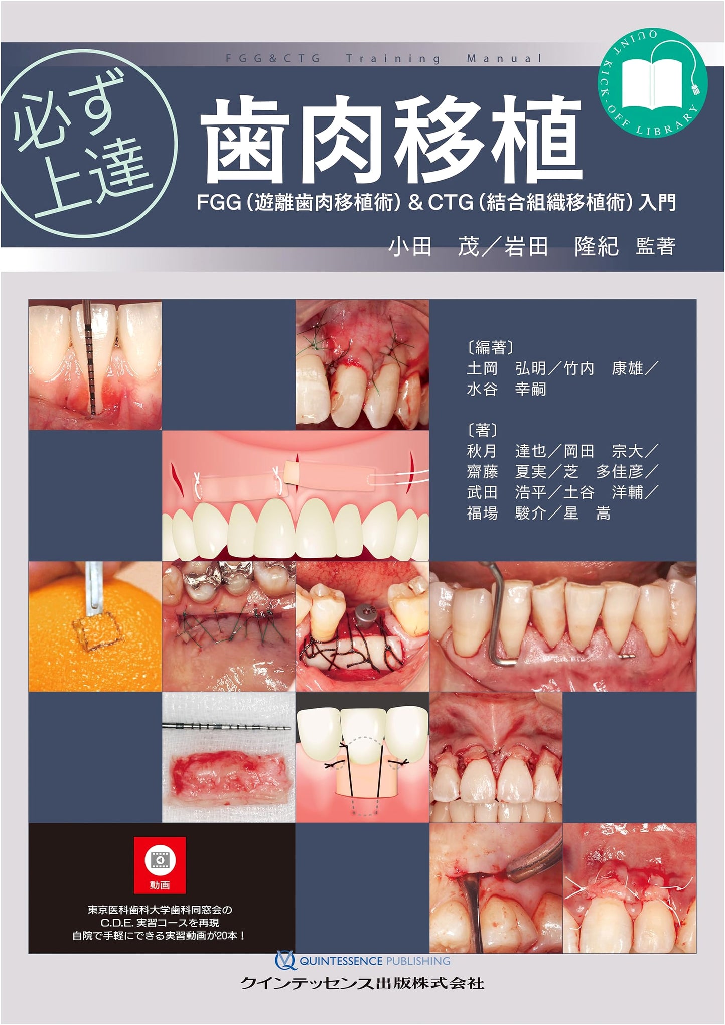 Mastering Gingival Grafting: FGG & CTG Introduction for Dental Professionals