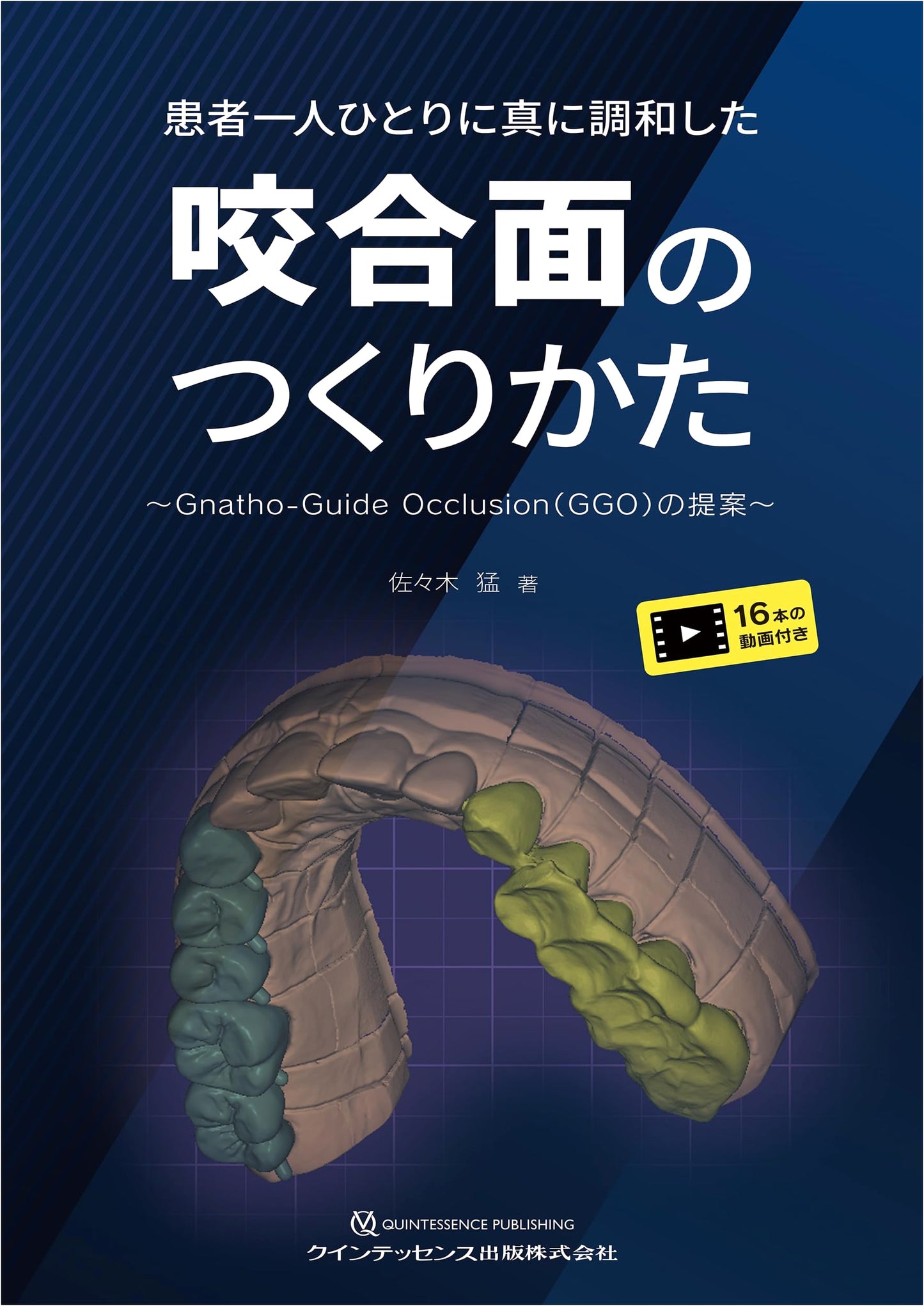 Crafting Harmonious Occlusal Surfaces for Each Patient: A Proposal for Gnatho-Guide Occlusion (GGO)