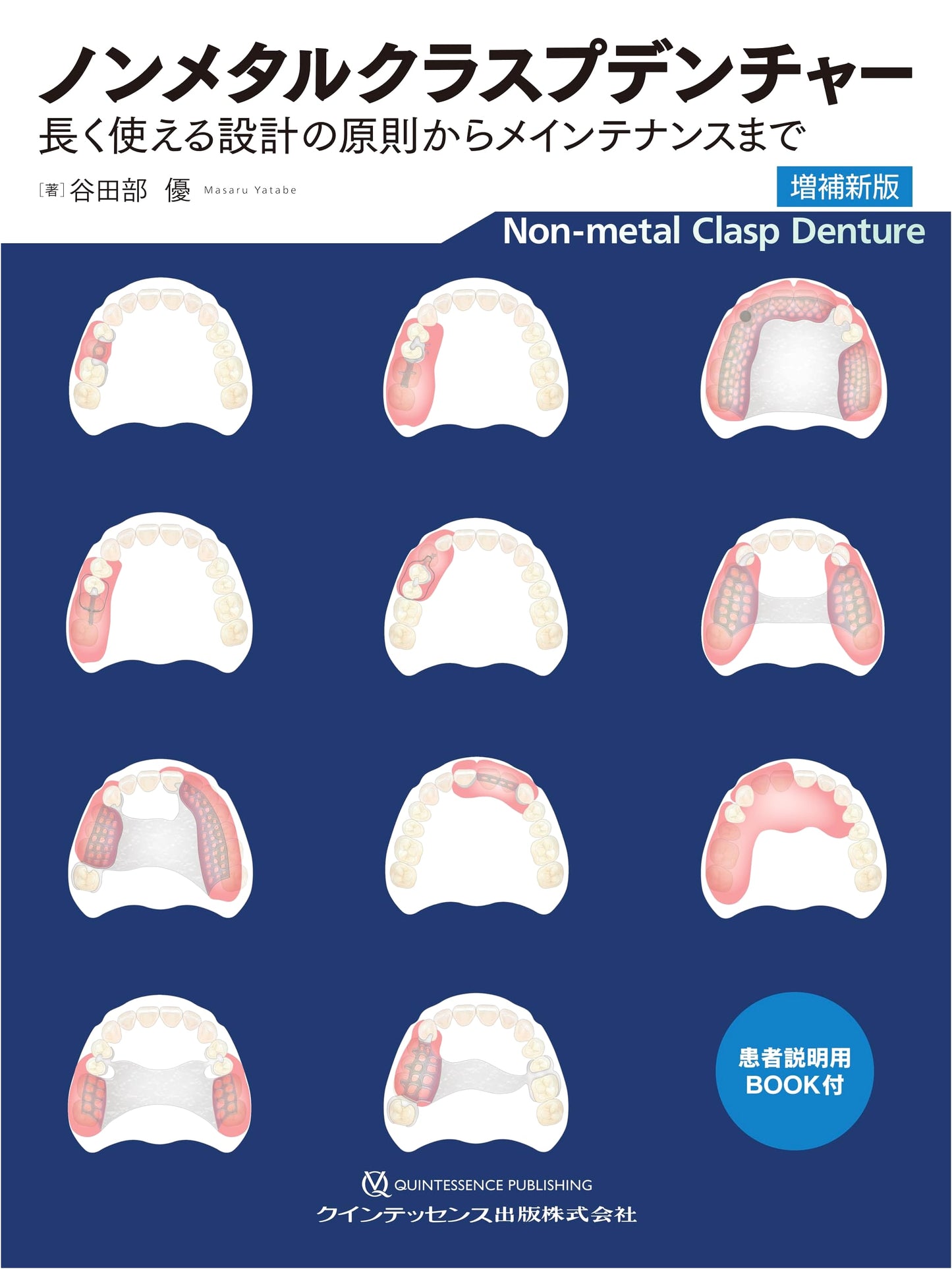 Non-Metal Clasp Dentures: Design Principles for Longevity & Maintenance - Revised Edition