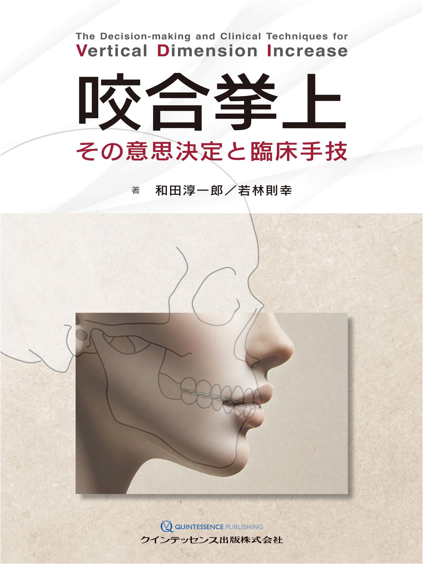 Occlusal Elevation: Decision Making and Clinical Techniques