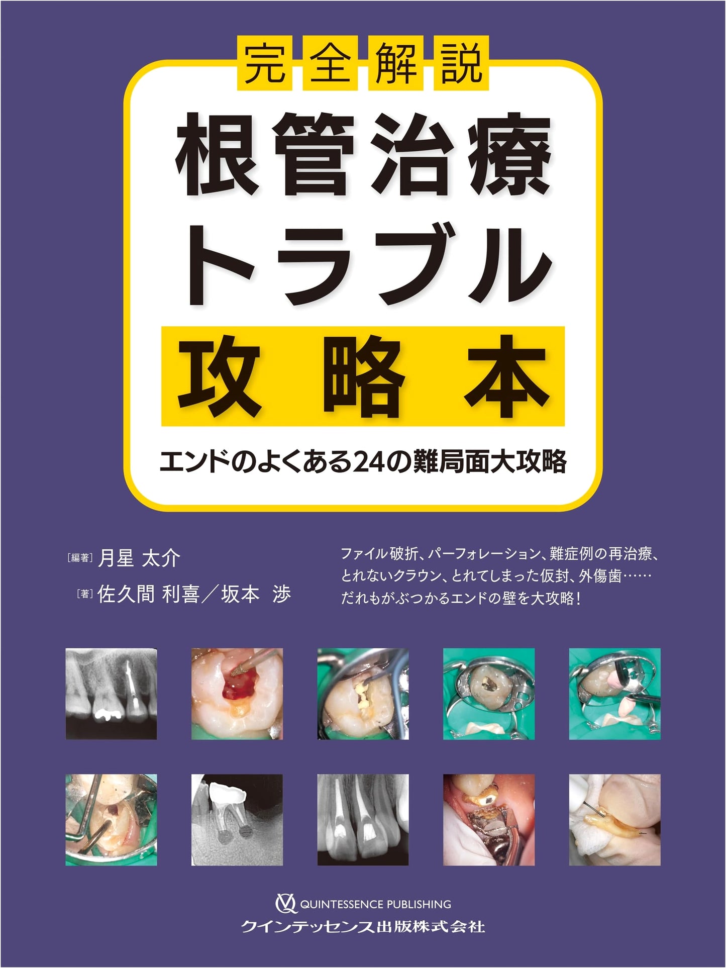 Conquering Endodontic Treatment Troubles: 24 Common Difficult Situations Explained