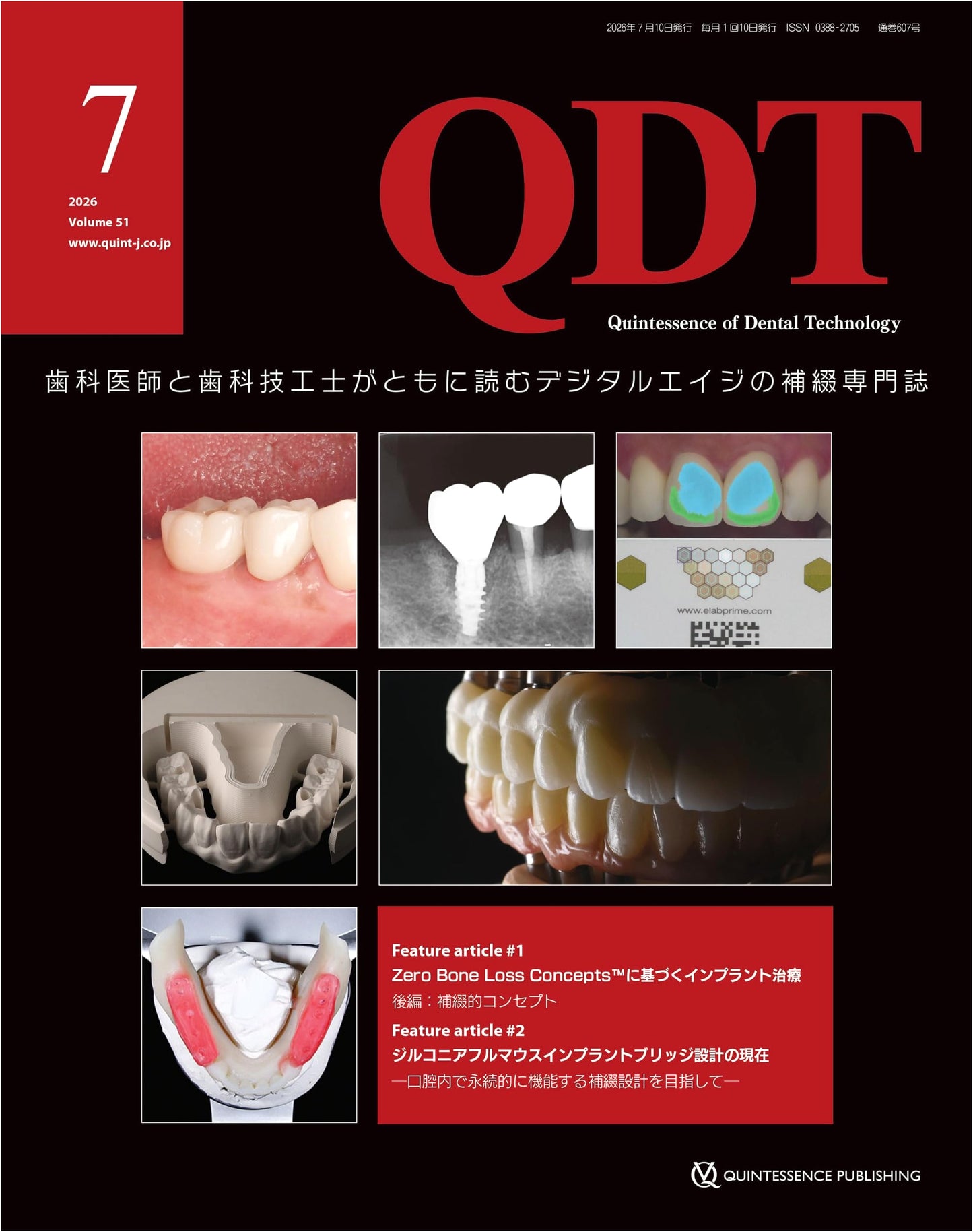 QDT July 2026: Prosthodontics for Dentists and Technicians in the Digital Age