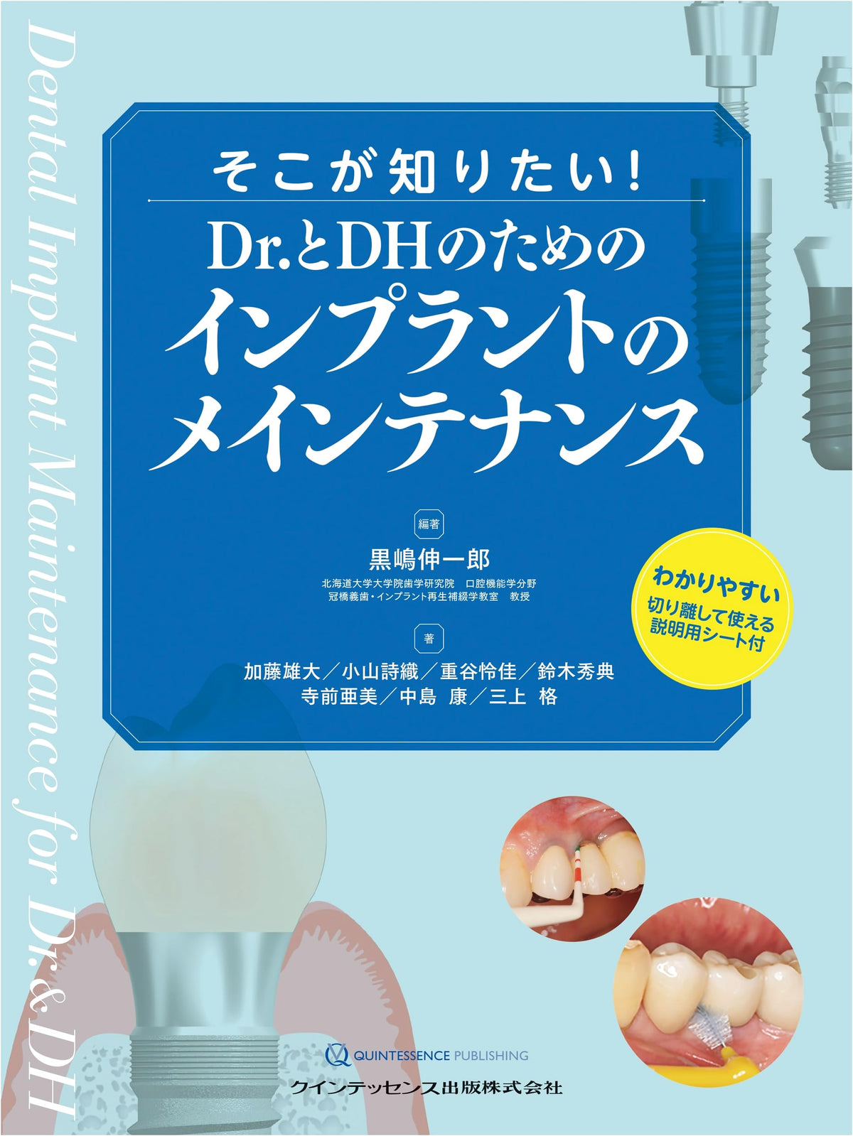Unveiling Implant Maintenance: A Guide for Doctors and Dental Hygienists