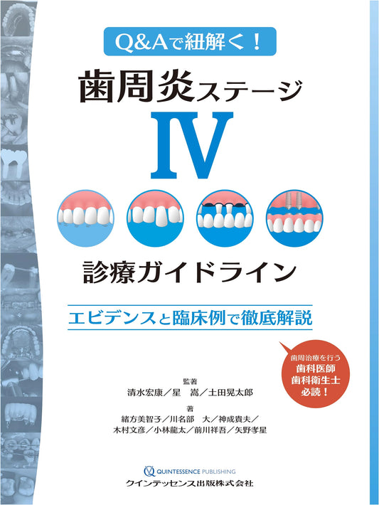 Clinical Guidelines for Stage IV Periodontitis: Evidence-Based Approaches & Case Studies