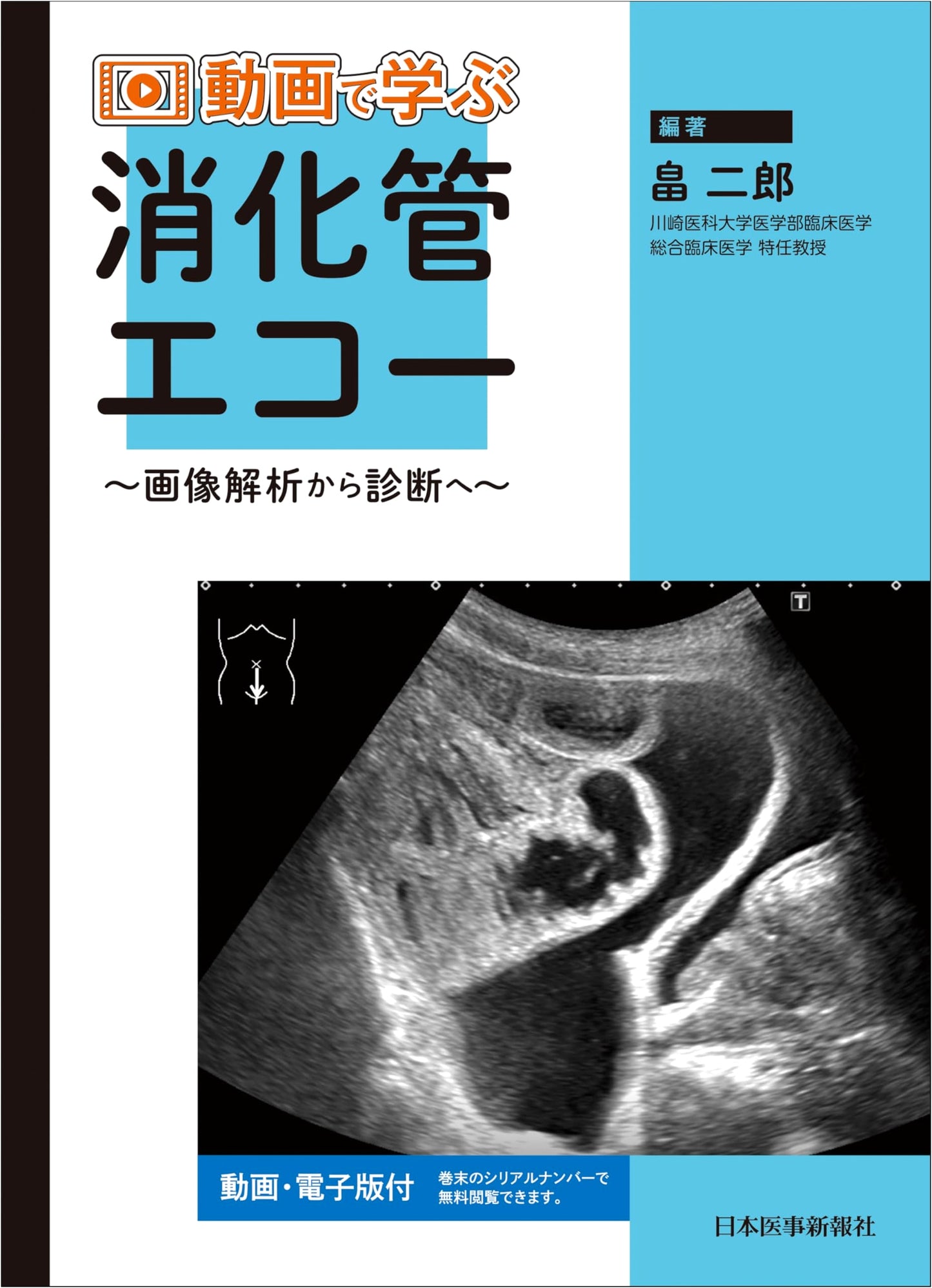 Video Learning Guide to Gastrointestinal Ultrasound