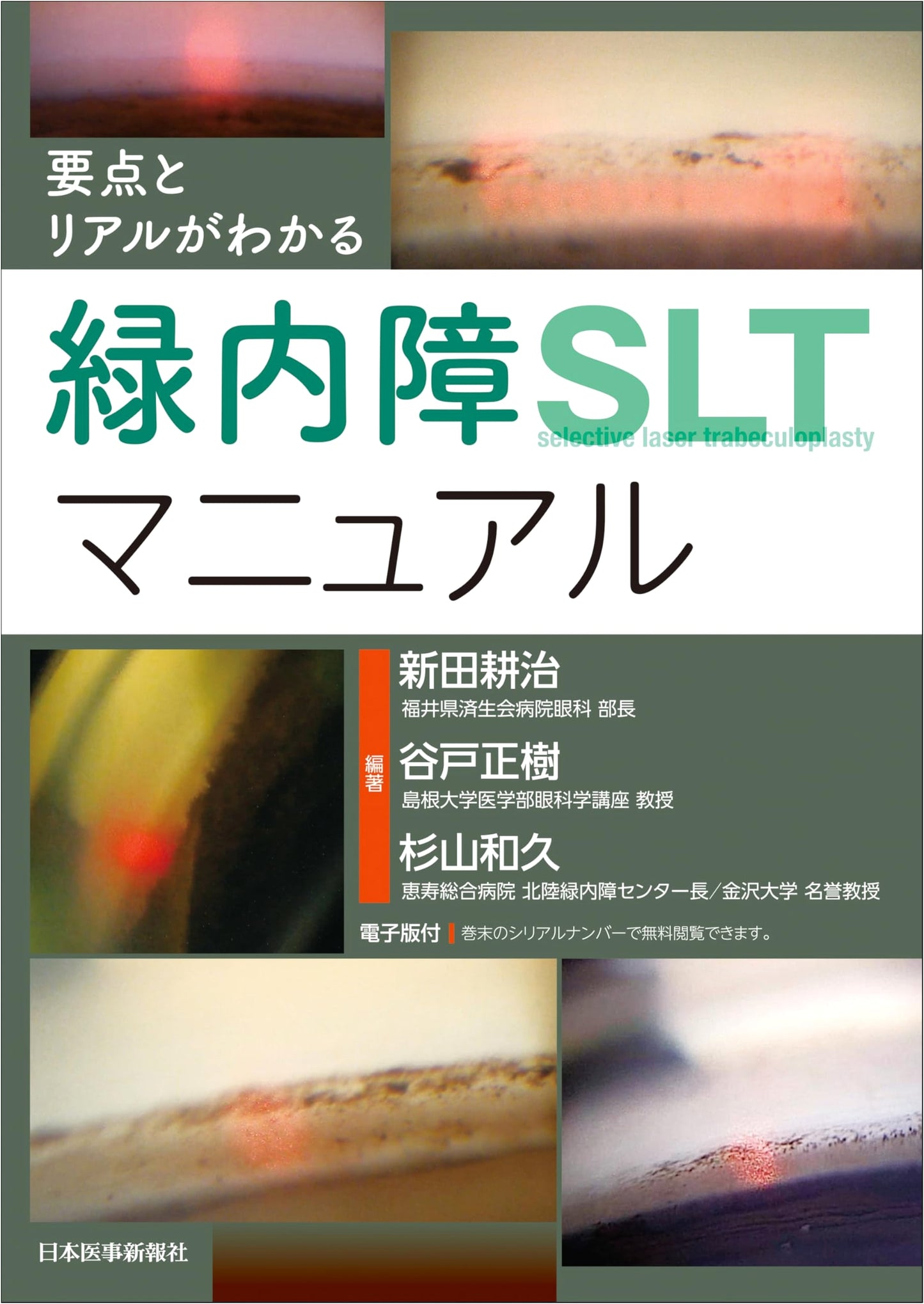 Glaucoma SLT Manual: Understanding Key Points & Realities