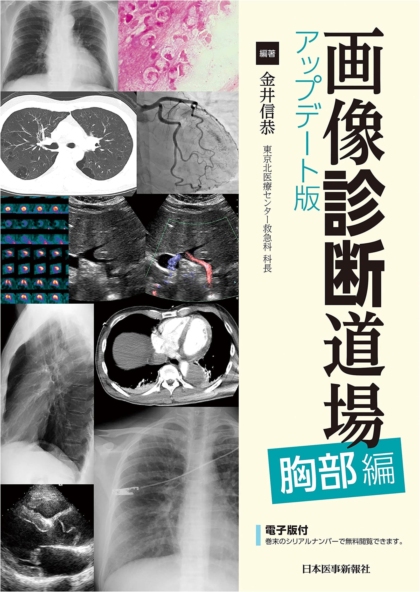 Diagnostic Imaging Dojo: Updated Edition - Chest Volume