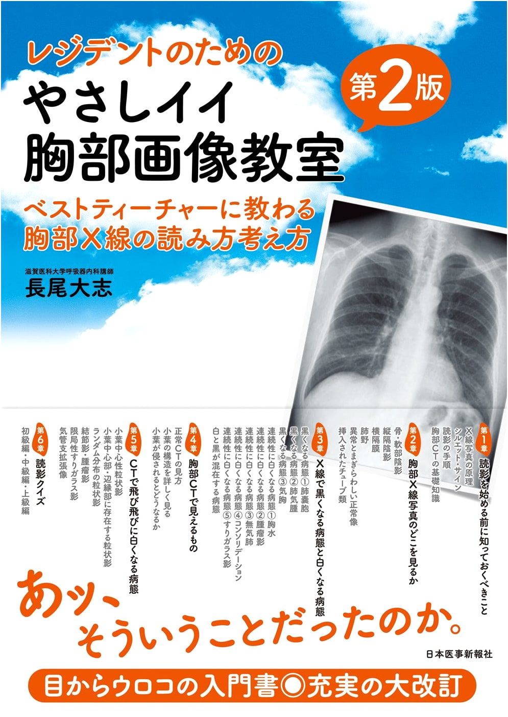 Resident's Guide to Chest Imaging: Interpreting Chest X-rays, 2nd Ed. by Taishi Nagao