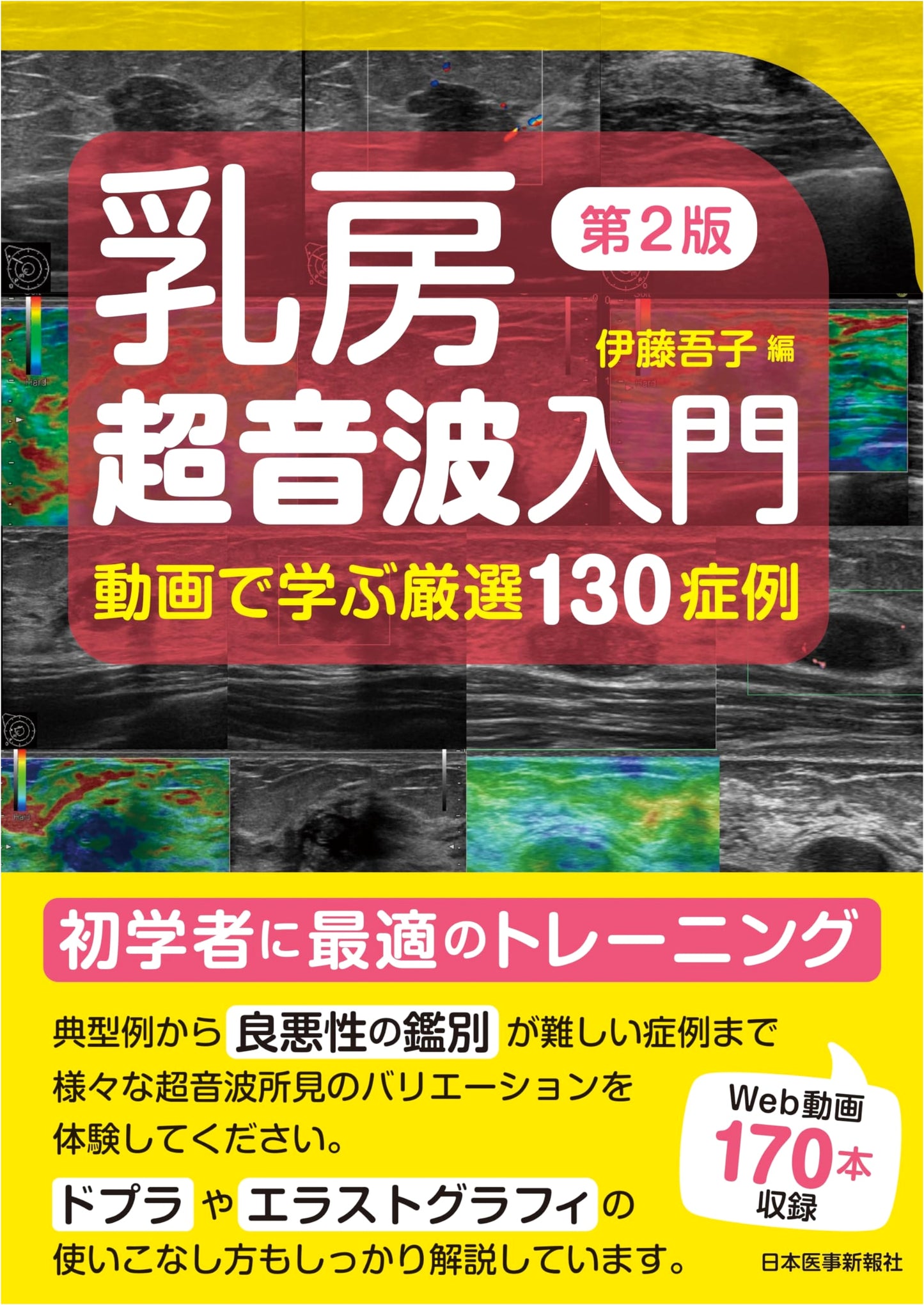 Breast Ultrasound Primer, 2nd Ed.: 130 Video Case Studies (Includes Digital Edition)