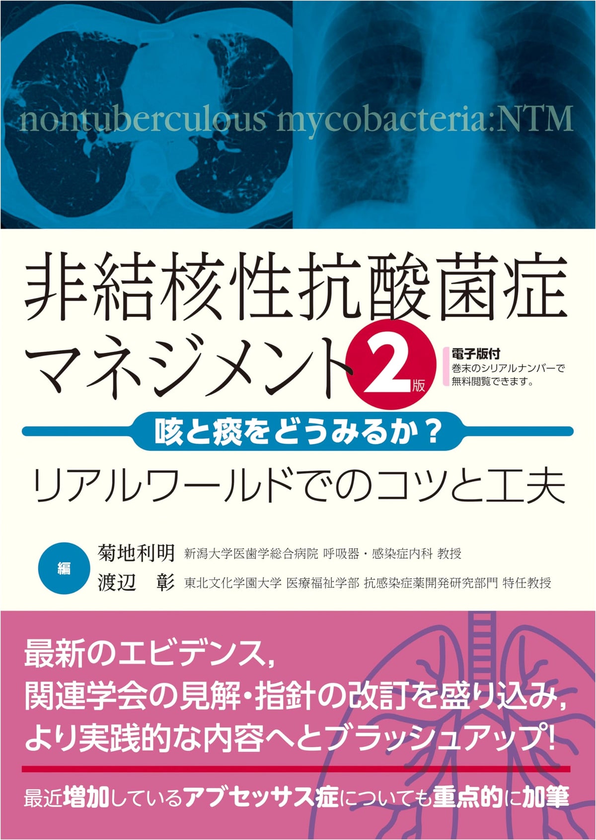 Nontuberculous Mycobacteriosis Management: Cough & Sputum - 2nd Ed.