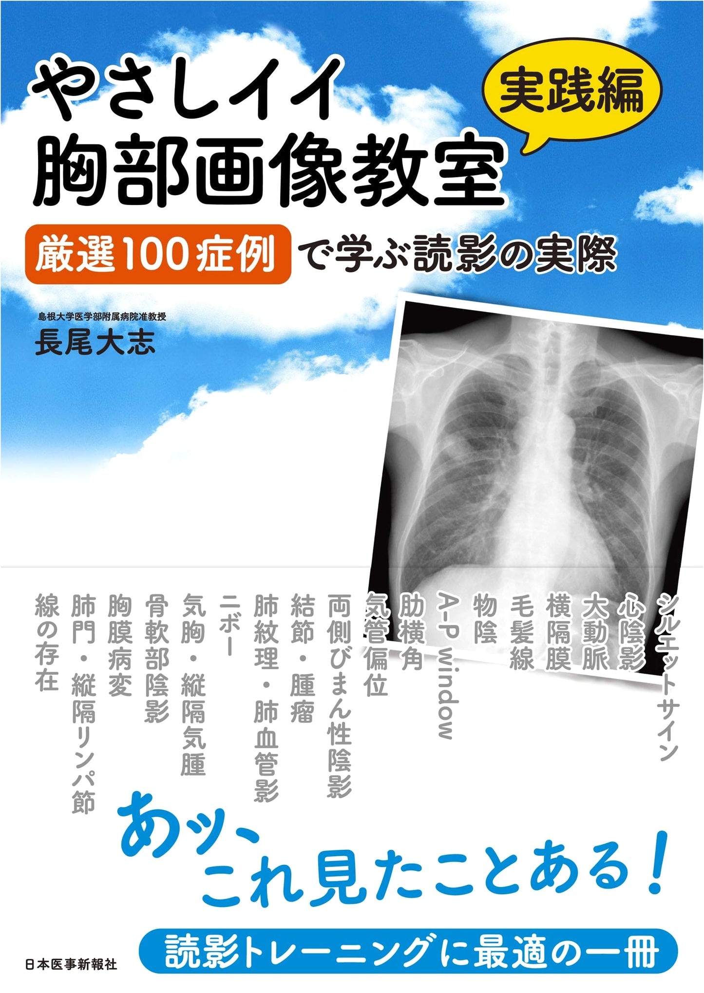 Easy & Good Thoracic Imaging Classroom: Practical Edition - 100 Cases for Learning Image Interpretation