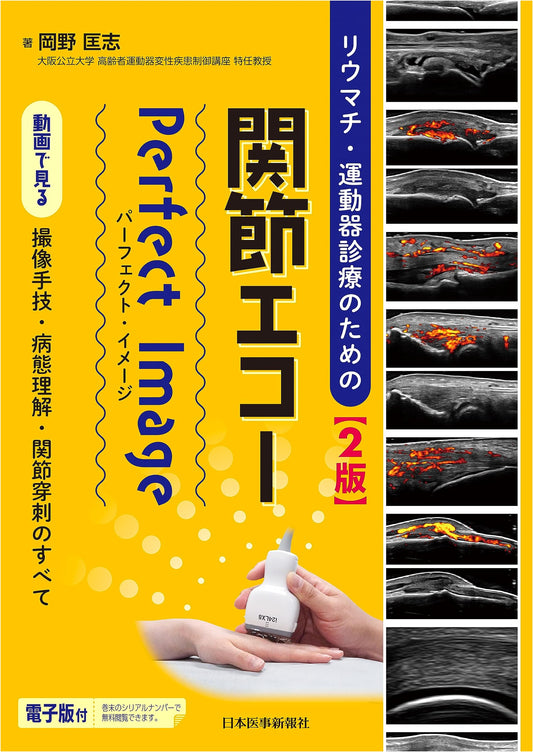 Rheumatism & Musculoskeletal Examination: Joint Ultrasound Perfect Image, 2nd Ed.