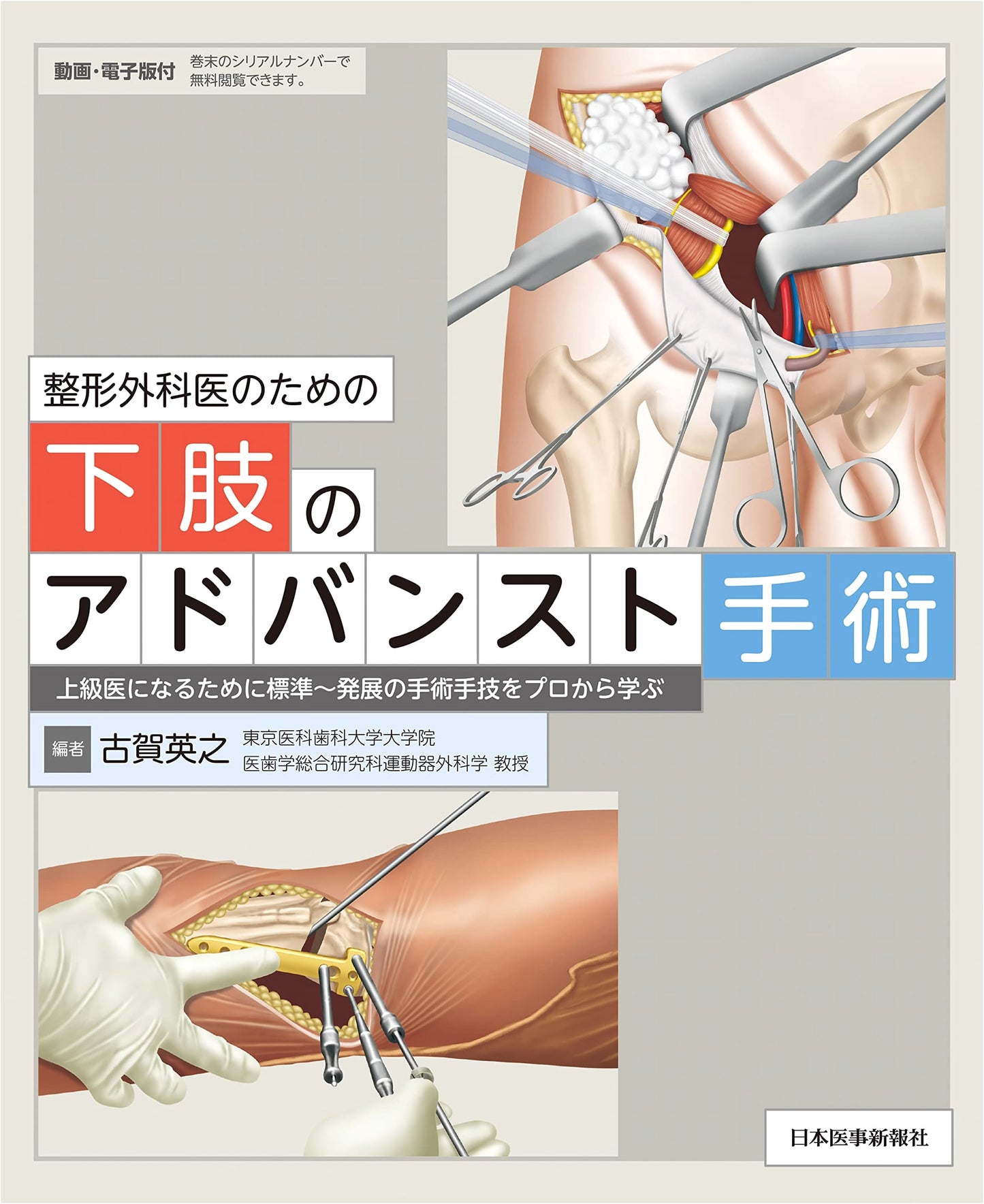 Advanced Lower Limb Surgery for Orthopedic Surgeons: Standard to Advanced Techniques