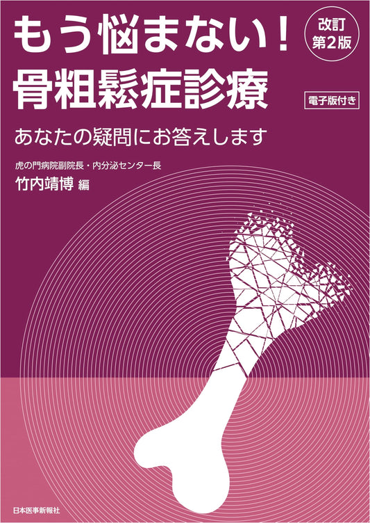 No More Worries! Osteoporosis Diagnosis and Treatment, Revised 2nd Edition