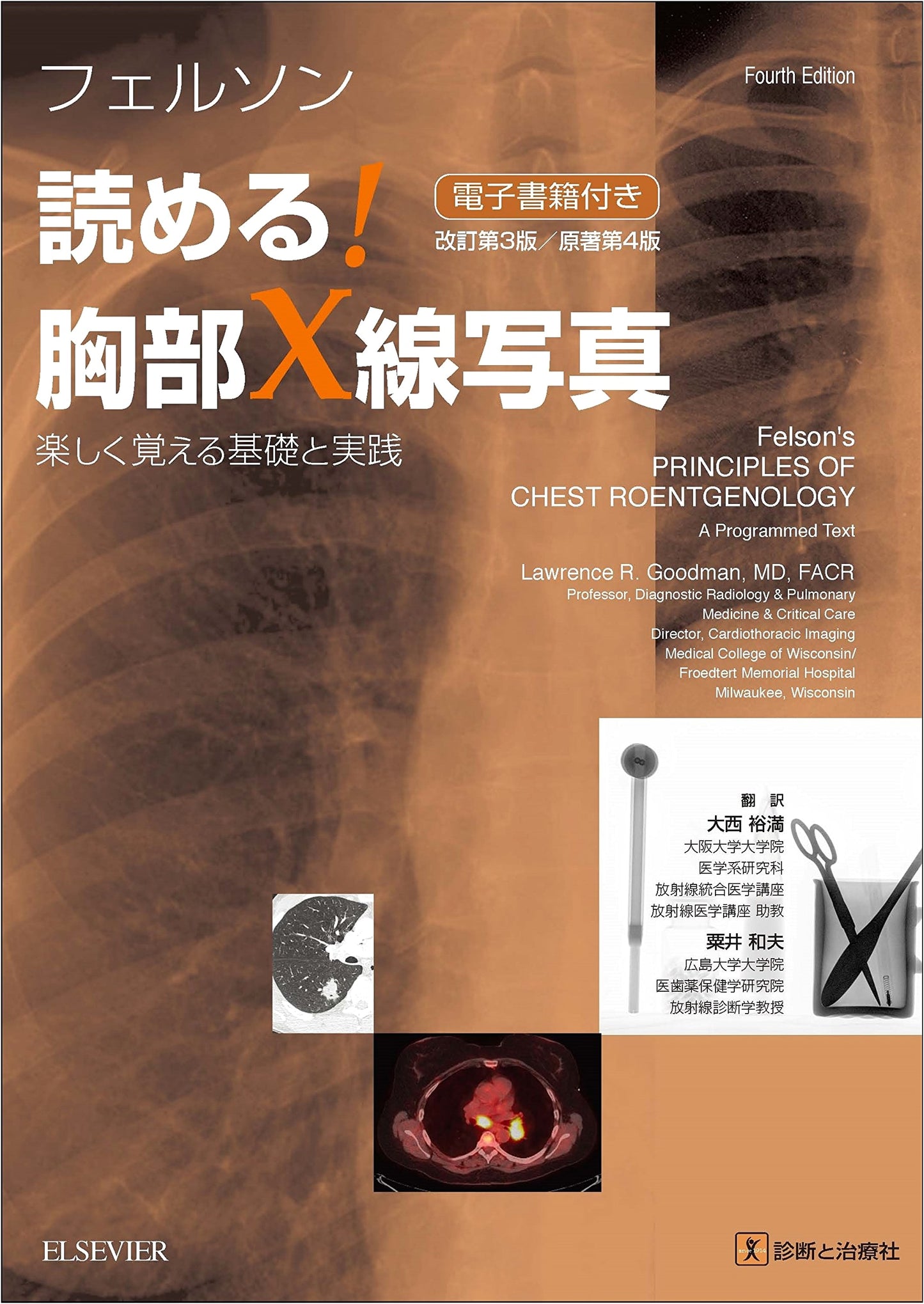 Felson's Chest X-Ray: Read It! Revised 3rd Edition/Original 4th Ed. Fun Basics & Practice