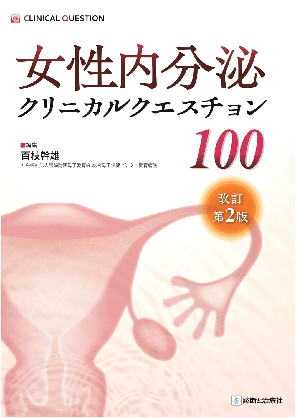 100 Clinical Questions in Female Endocrinology, Revised 2nd Edition