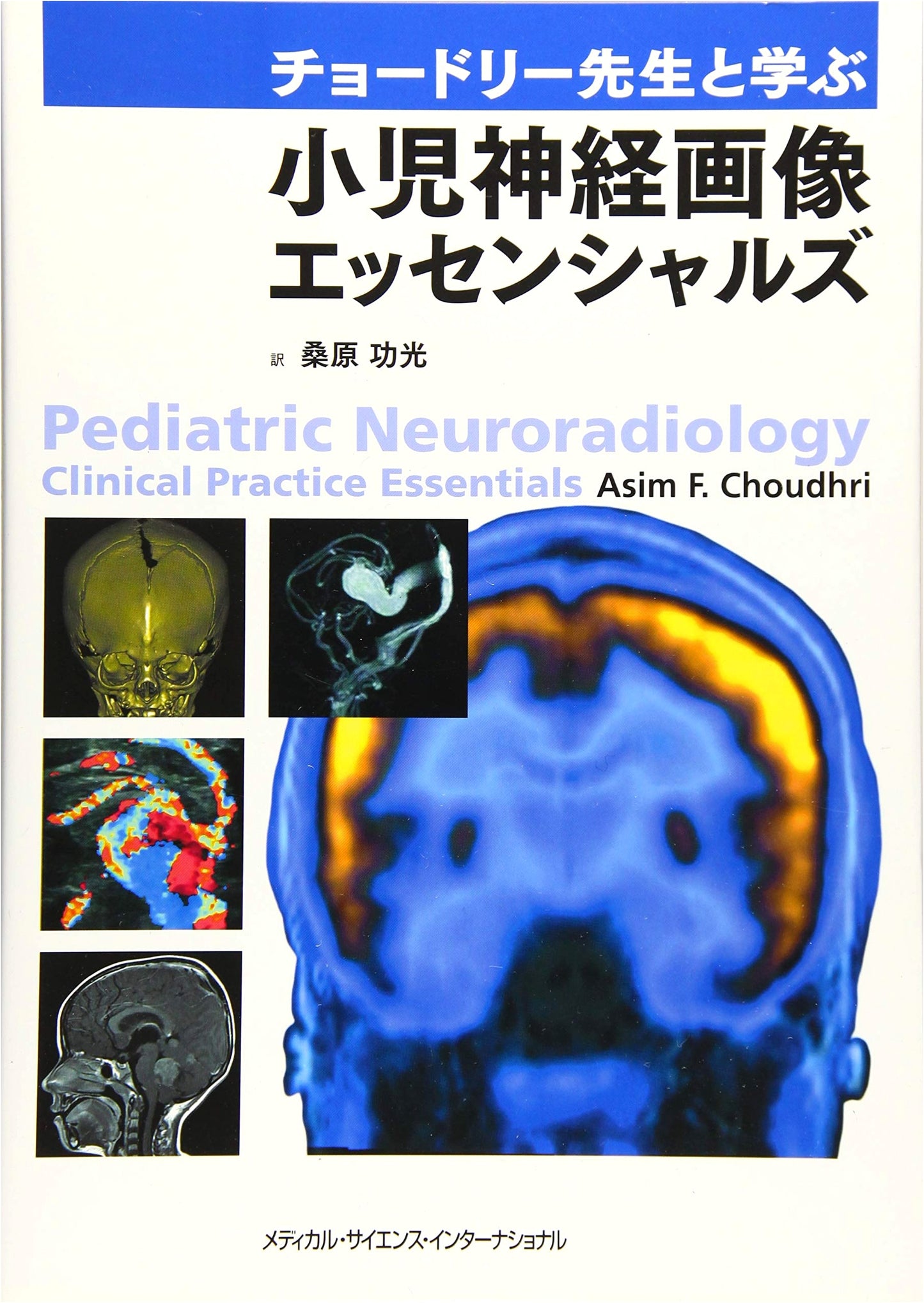Pediatric Neuroimaging Essentials: Learning with Dr. Choudhury