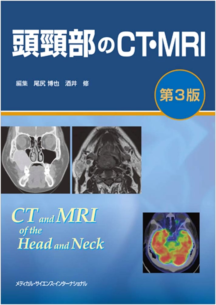 CT and MRI of the Head and Neck, 3rd Edition