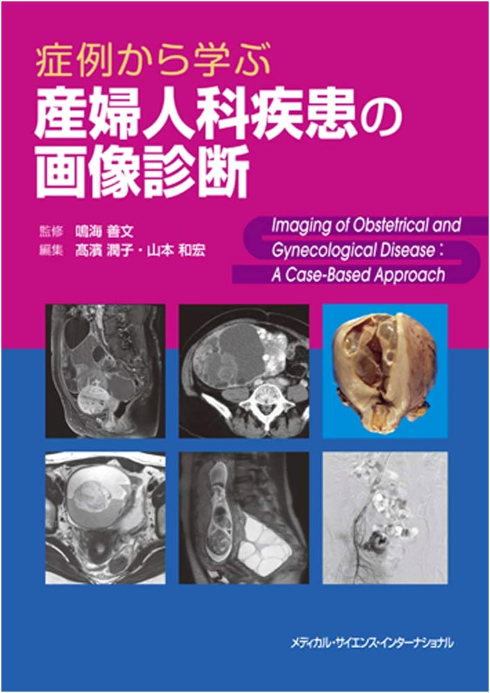 Gynecologic Imaging: Learning from Case Studies