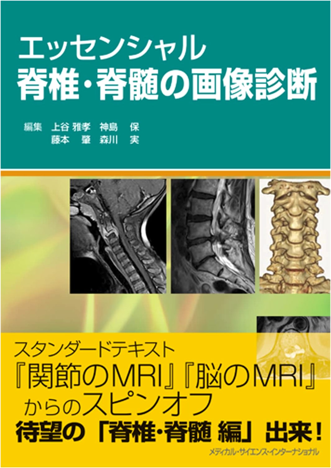 Essential Diagnostic Imaging of the Spine and Spinal Cord
