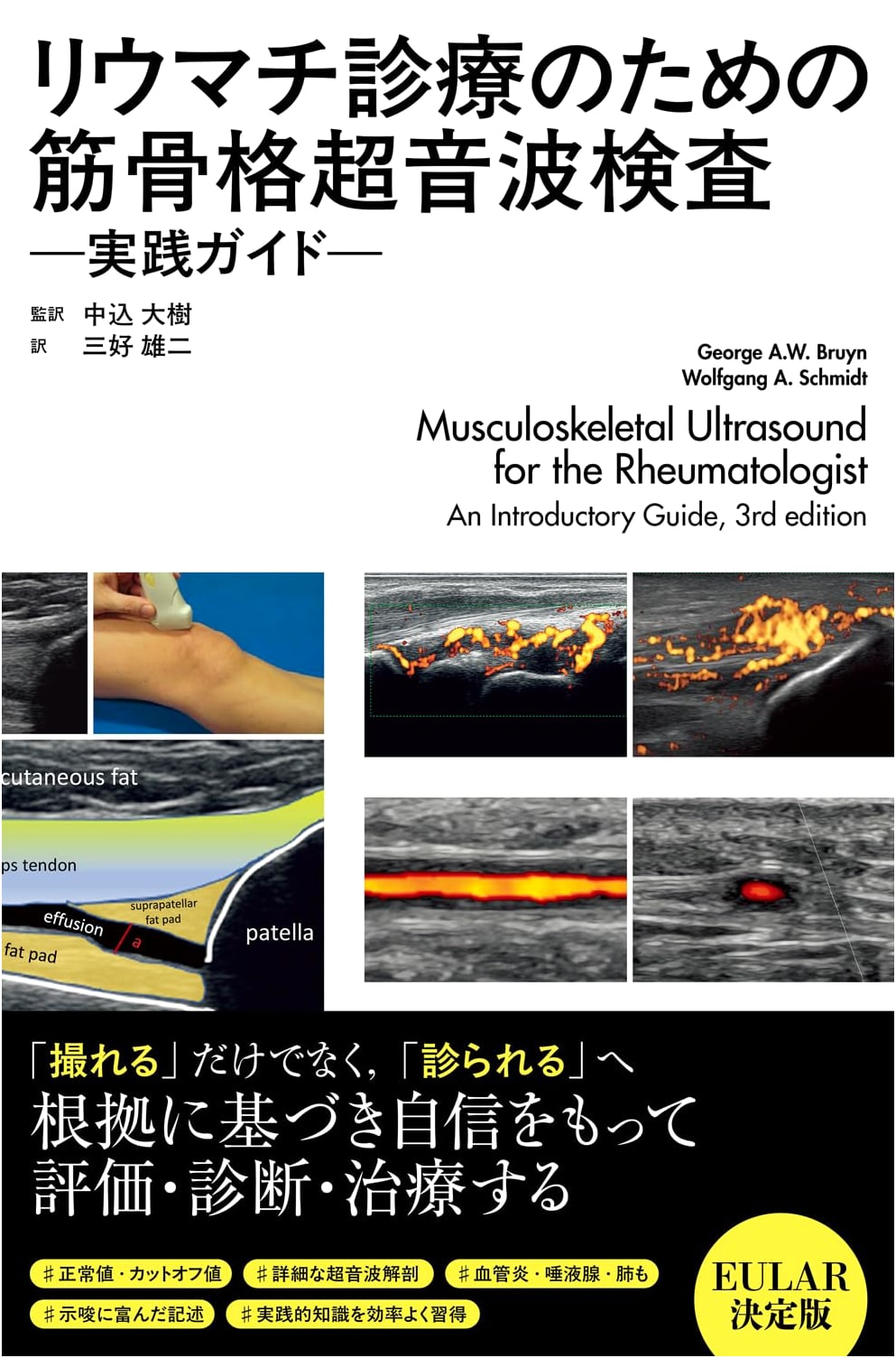 Musculoskeletal Ultrasound for Rheumatology: A Practical Guide
