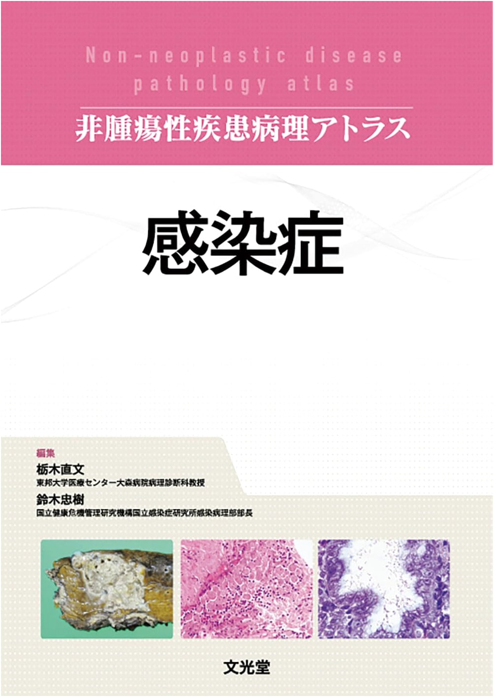 Infectious Diseases (Non-Tumorous Disease Pathology Atlas)