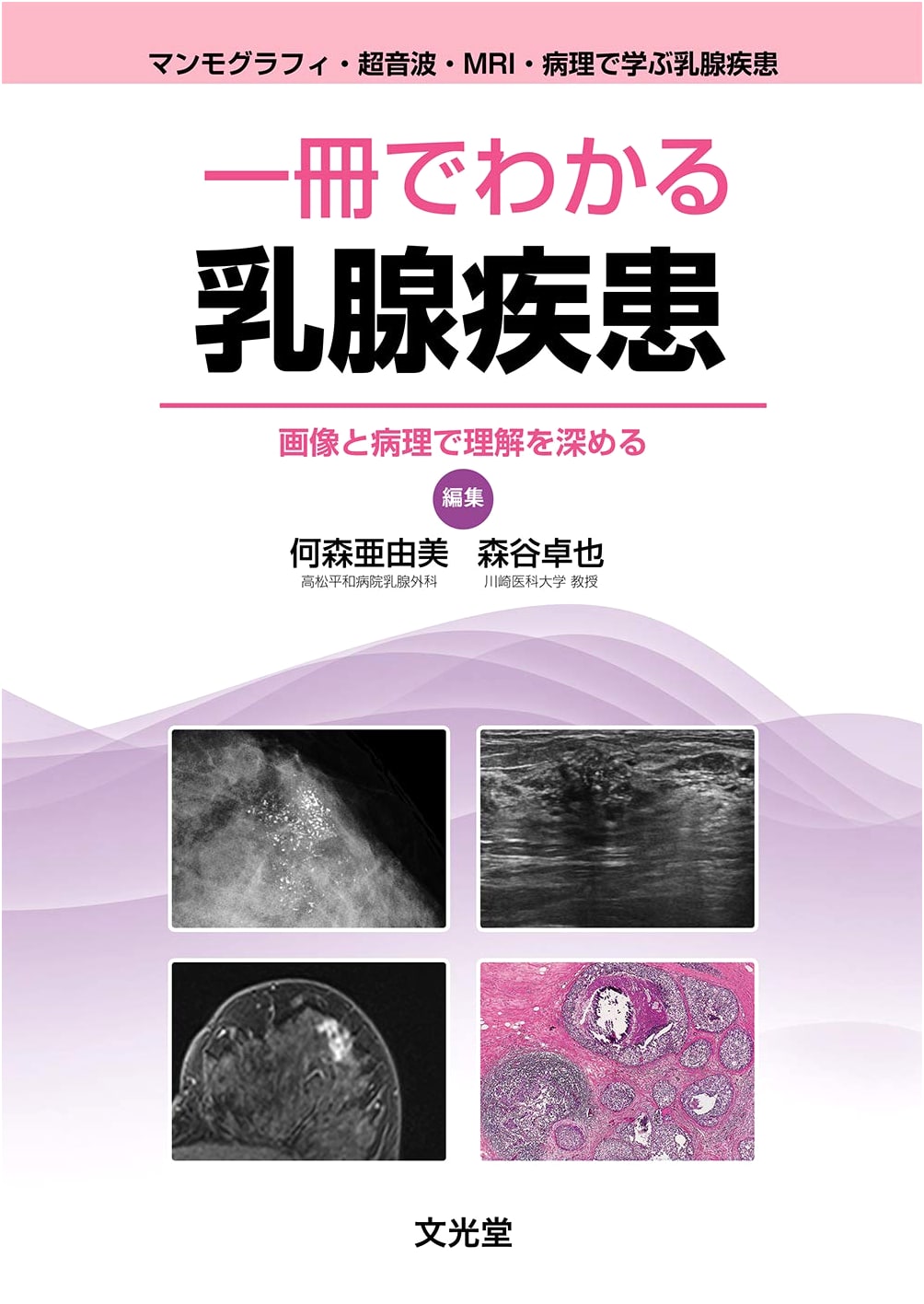 Understanding Breast Diseases: A Comprehensive Guide
