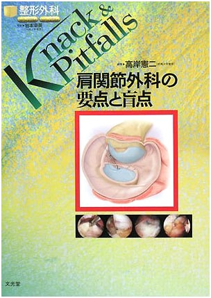 Shoulder Joint Surgery: Key Points and Pitfalls - Orthopedic Knack & Pitfalls Series