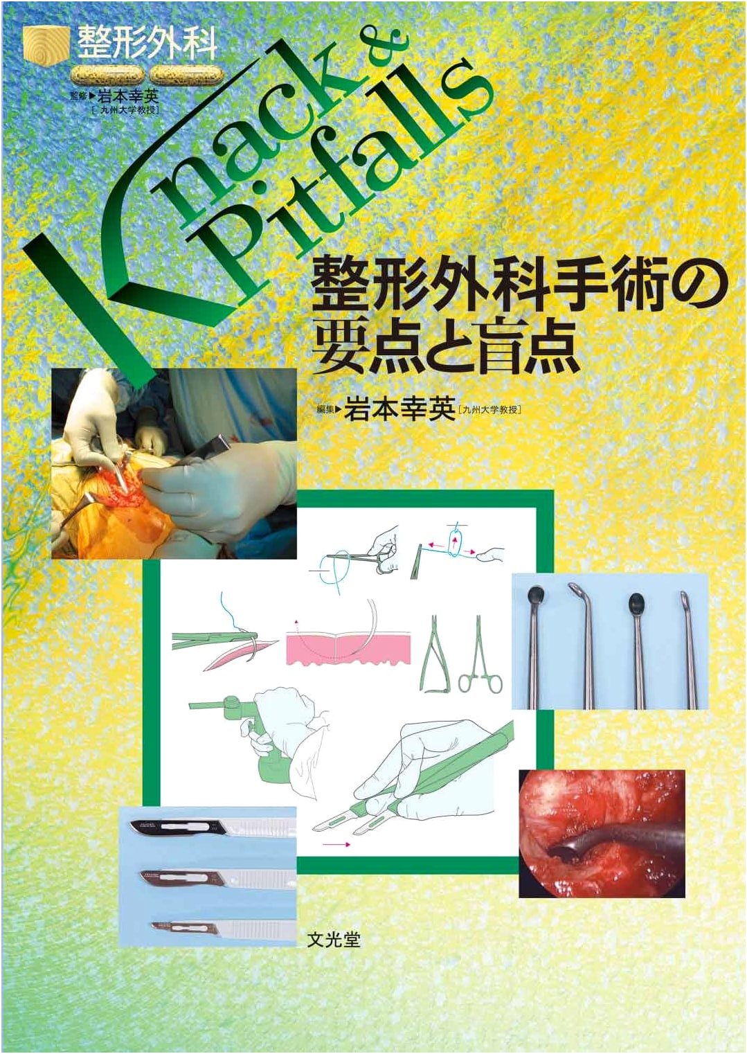 Orthopedic Surgery: Key Points & Pitfalls (Orthopedic Surgery Knack & Pitfalls Series)