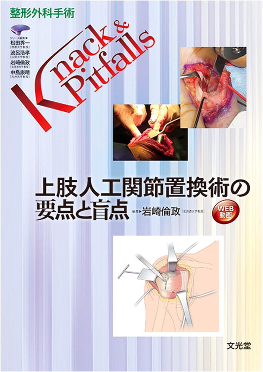 Upper Extremity Prosthetic Joint Replacement: Key Points & Pitfalls in Orthopedic Surgery