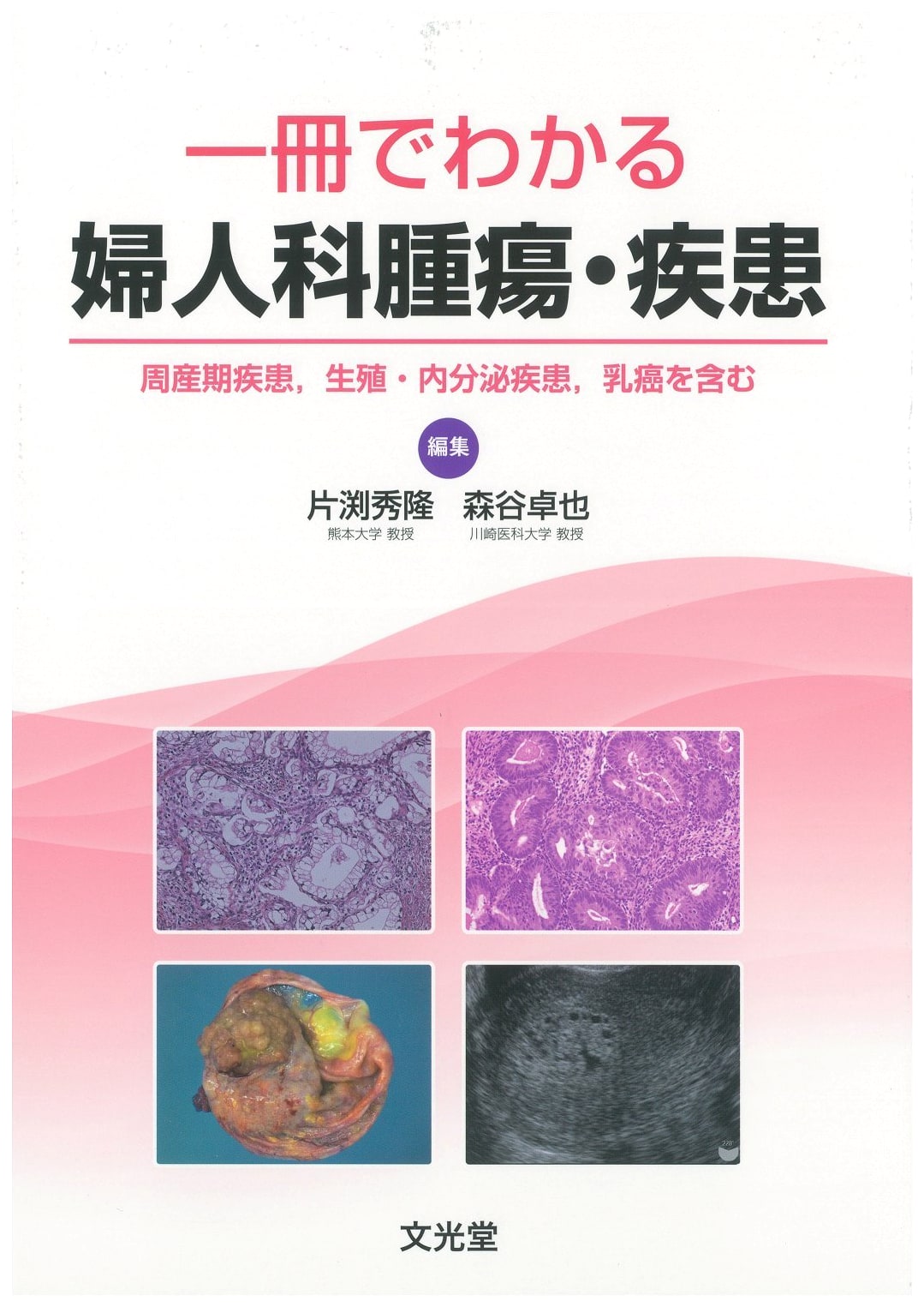 Understanding Gynecology Tumors and Diseases in One Volume